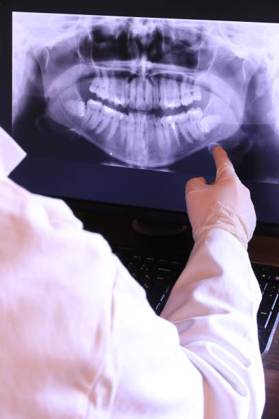 Best Emergency Dental Care for Broken or Chipped Teeth in Dousman, WI