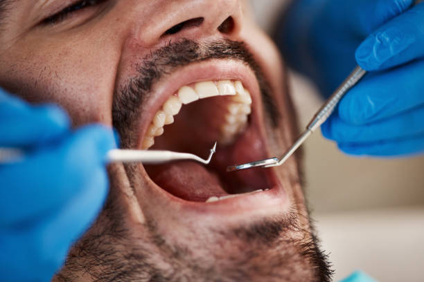 Best Emergency Dental Care for Broken or Chipped Teeth in Dousman, WI